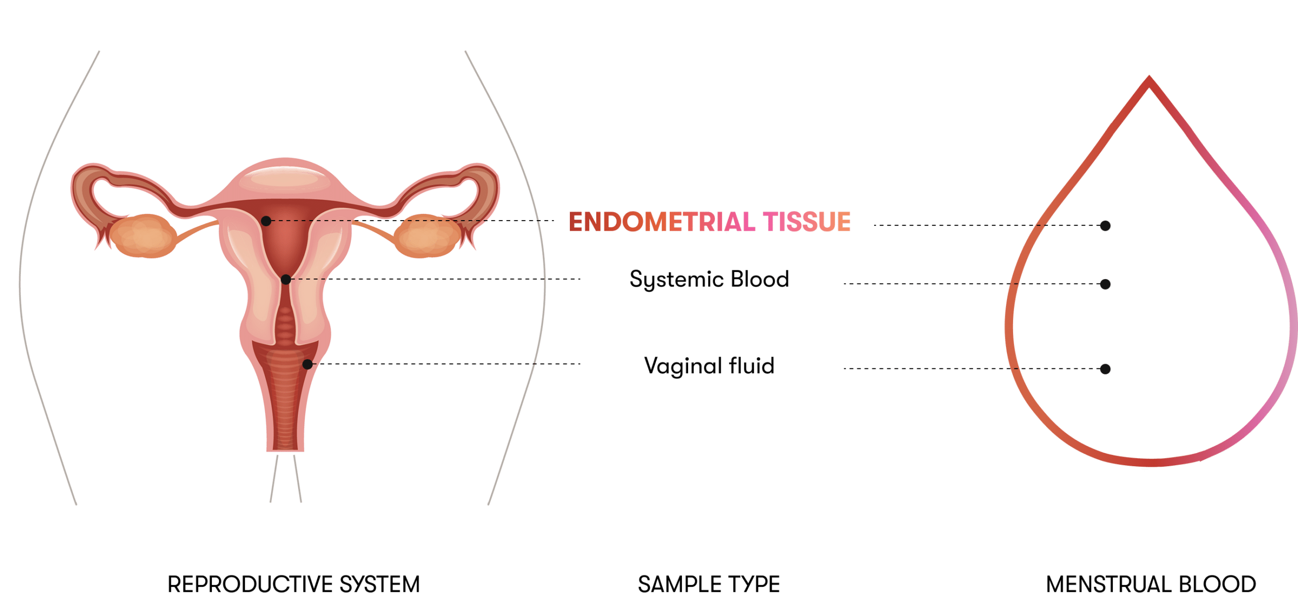 Shed endometrial tissue carried in menstrual blood